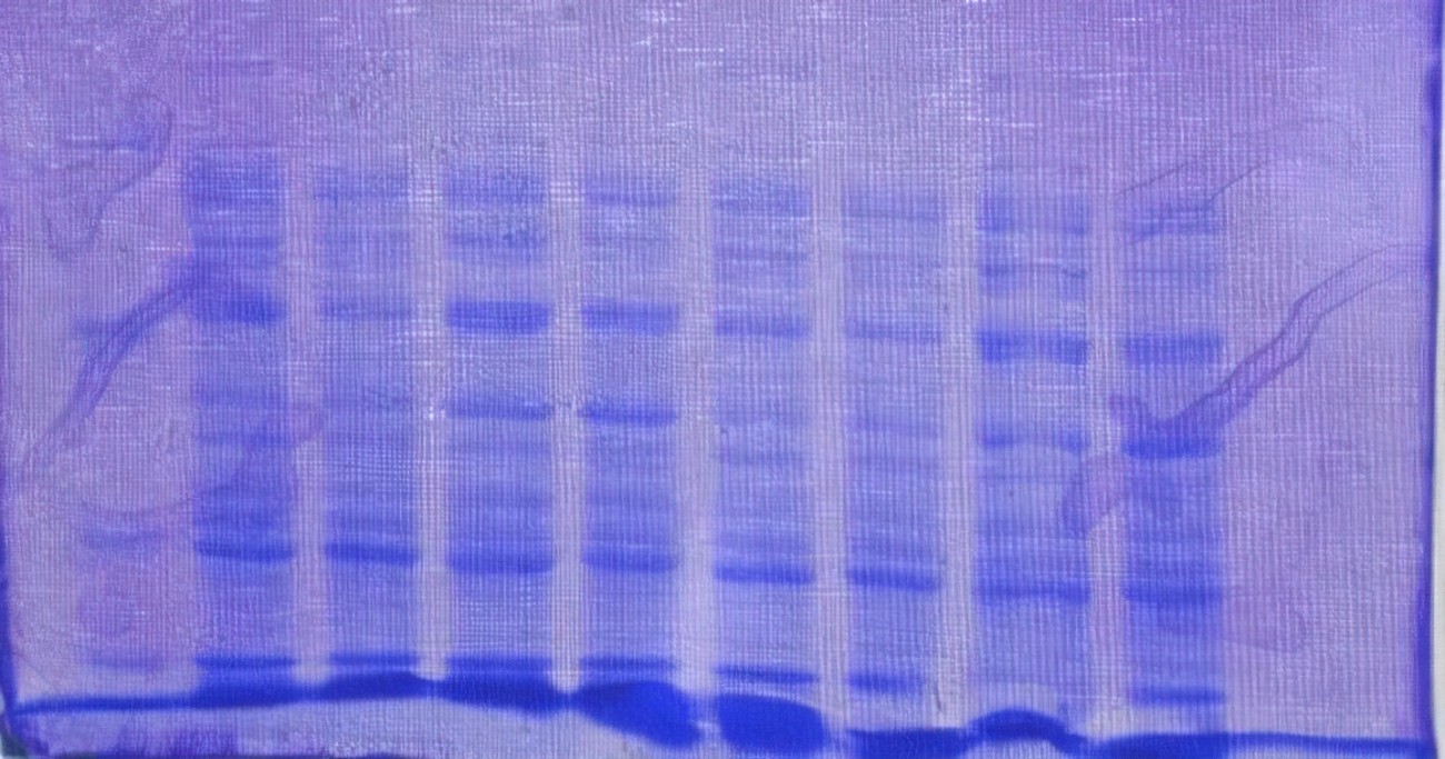 聚丙酰胺凝胶电泳